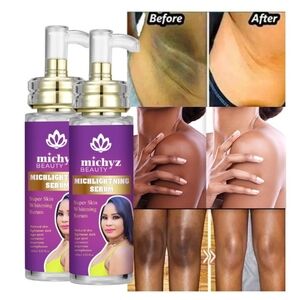 Michlight face and body serum for acne dark spots, this is the miracle serum